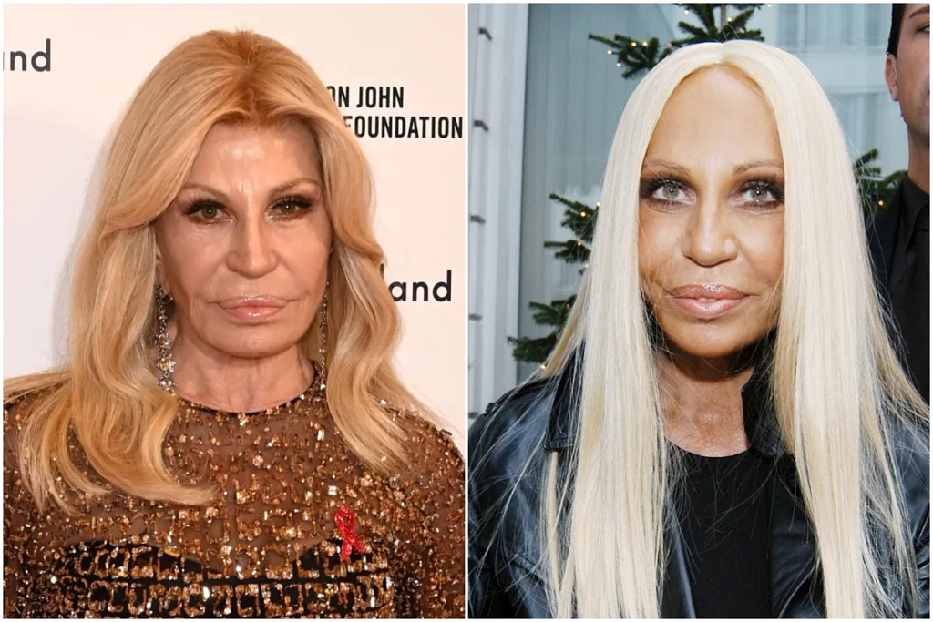 Donatella Versace impacta con nuevo rostro
